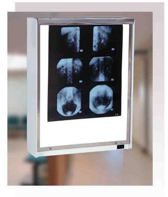 Négatoscope, Podoscope