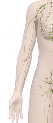 Lymphoedème ou syndrome du gros bras