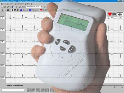 ECG Electrocardiographe
