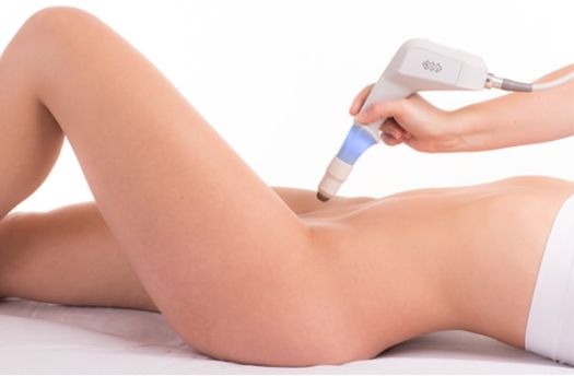 Exilis Ultra Femme 360