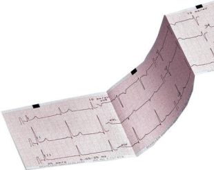 PAPIER ECG DELTA 1 CARDIOLINE