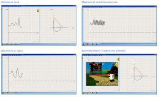 Ecrans selon les tests de spirométrie BTL 08
